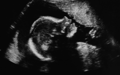 Indiana Students Will Learn Fetal Development In Schools